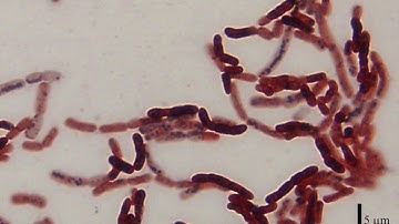 Exponential Growth and Bacteria