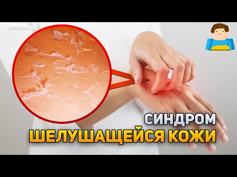 Из-за этого редкого синдрома кожа постоянно шелушится | Plushkin