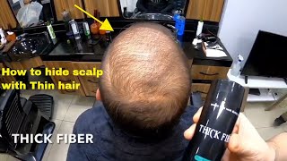 How to Hide Scalp with Thin Hair l Hair loss Transformation