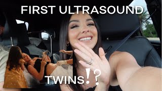 OUR FIRST ULTRASOUND FOR BABY NUMBER 5! TWINS!!?? | The Chavez Family