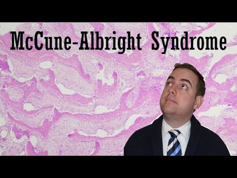 Syndrome Series: McCune-Albright Syndrome