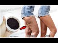 How to get rid of cellulite on your thighs and legs in 2 weeks, naturally and without training