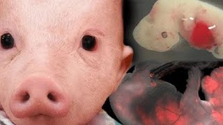 Evil Scientists Who Experimented On Humans - Part 3