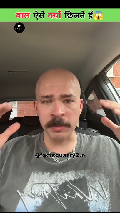 hair-loss-disease-youtube
