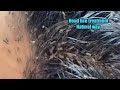 Head lice treatment in natural way/remove head lice in a single day/kuto removal/home remedy lice