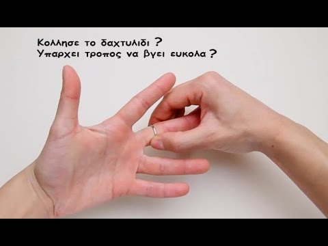 Βίντεο: Έχει σημασία το μέγεθος του δαχτυλιδιού αρραβώνων;