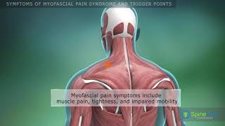 Симптомы. Миофасциальный синдром и триггерные точки. (субтитры)