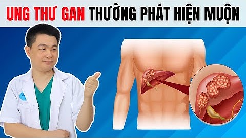 Tại Sao Ung Thư Gan Thường Phát Hiện Muộn? Bác Sĩ Chiều
