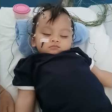 Rekam Otak (EEG)