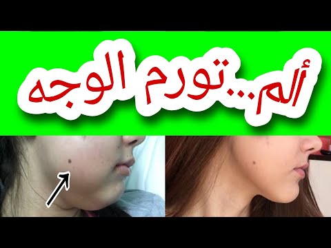 مضاعفات زراعة الأسنان وما هو الحل مع الألم والتورم