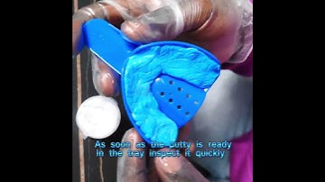 dental Impression Kit (get your mold done step by step)