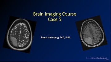 Brain imaging course – Unknown case 5