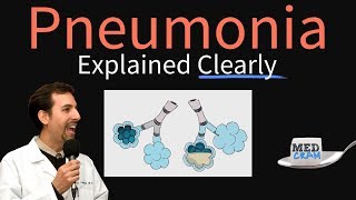 Pneumonia Explained Clearly by MedCram.com