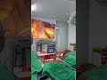 Sleeve gastrectomy for weightloss/Bariatric surgery by Dr Mansab Ali safe operation #roboticsurgeon