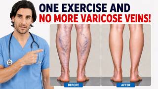 Celebrity Varicose Vein Relief — The 5-Minute Evening Ritual for Heavy, Tired Legs Net Worth
