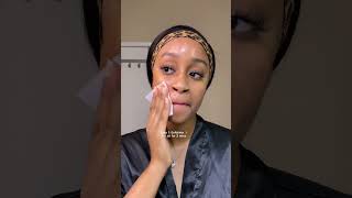 I TRIED DR DENNIS GROSS PEEL PADS FOR 30 DAYS AND THIS HAPPENED #skincare #acne #hyperpigmentation