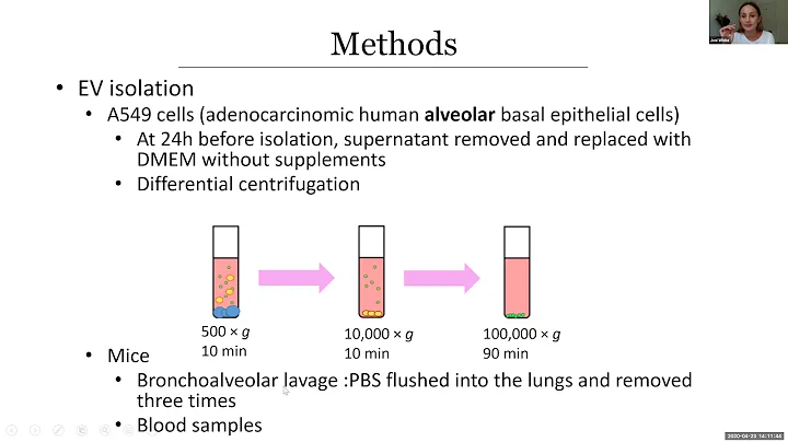 "Host exosomes can protect against bacterial toxin...