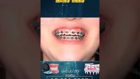 [3D] NIỀNG RĂNG || Nha Khoa Quốc Tế Athena