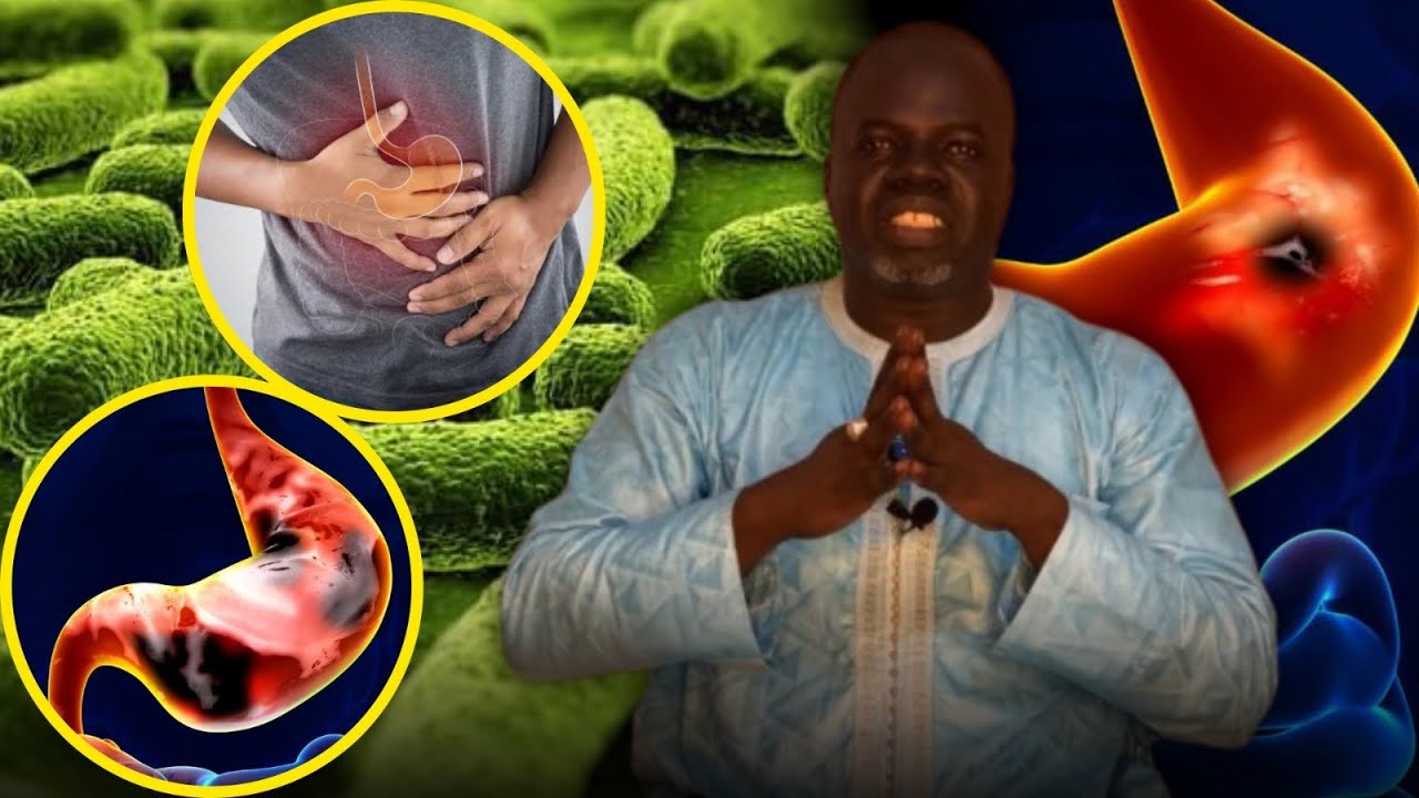 Ulcère d’Estomac #1 - ( Causes et Conséquences ) - Pr Ousmane Ndiaye - SAMA XALAAT TV