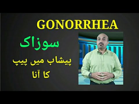 Gonorrhea::what are symptoms and how it is managed?