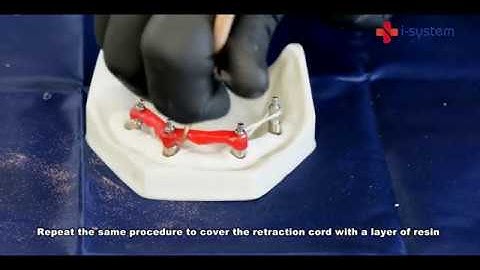 Open Tray for Multi Unit Impression Coping