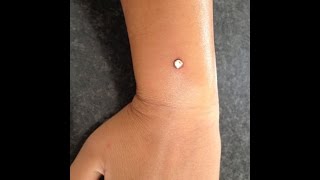 Micro Dermal Piercing (Arm)