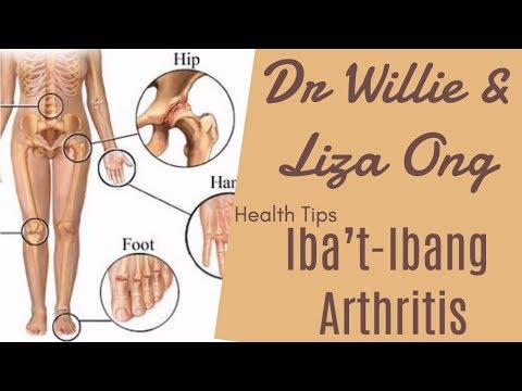 Iba’t-Ibang Arthritis: Osteoarthritis, Gout - ni Doc Ging Zamora-Racaza (Rheumatologist) #6