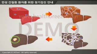 [시연용] b0040aako 축약판 만성 간질환 환자를 위한 정기검진 안내