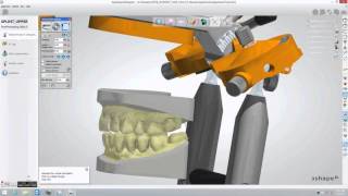 3Shape upper splint design