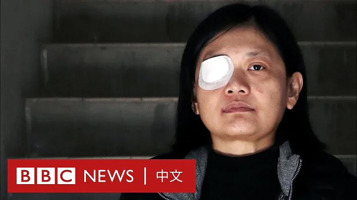 香港示威：右眼失明的印尼女记者控诉“警暴”－ BBC News 中文 - 天天要闻