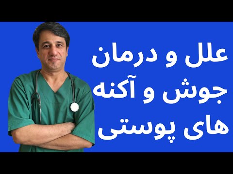 تصویری: منظور از تاولی چیست؟