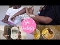 A WEEK OF EXTREME HIGH BLOOD SUGARS | DAY IN THE LIFE OF  TYPE 1 DIABETES