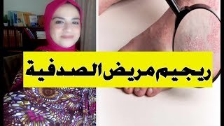 psoriasis diet l علاج الصدفية - الحمية الغذائية والاحتياطات الضرورية