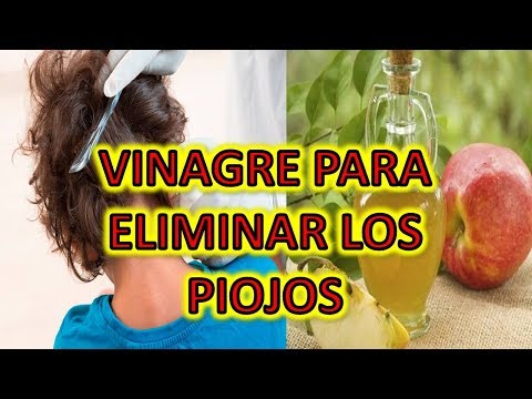 Elimina Los Piojos Y Liendres Con Vinagre – Adiós A Los Piojos Y Liendres Con Vinagre Natural