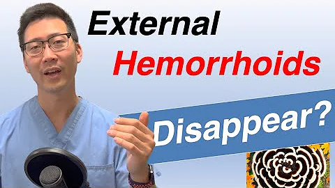 Can External hemorrhoids go away on their own? Does treatment matter? - DayDayNews