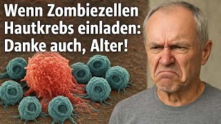 Sonnenbrand, Zombiezellen und dann? Melanom deluxe.