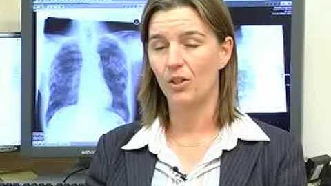 Saving money using digital x-rays rather than film - part two