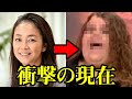 元『オセロ』中島知子の衝撃の現在に一同驚愕　元相方の松嶋尚美もヤバすぎる