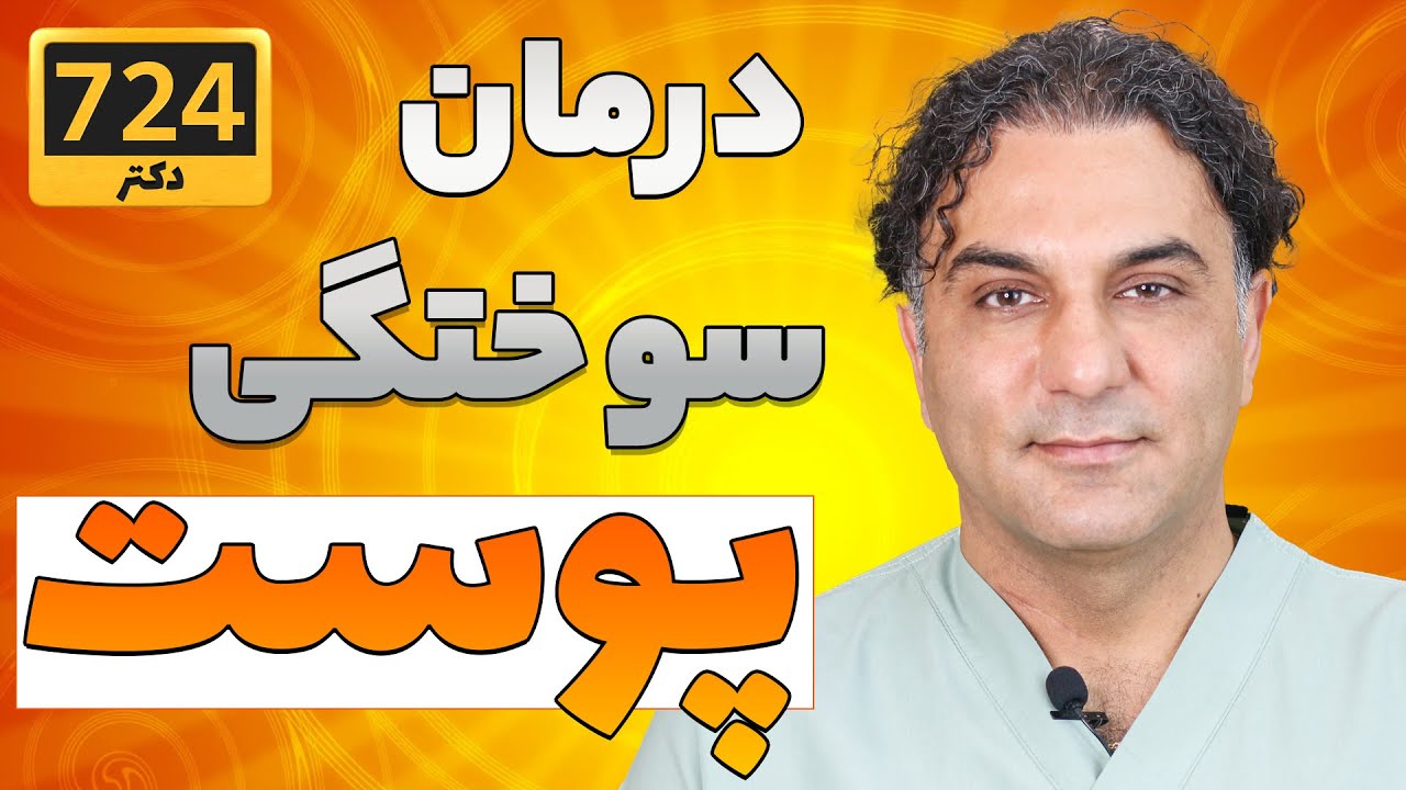 باید و نبایدهای درمان سوختگی پوست | skin burn