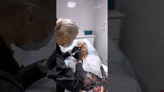 Контурная пластика губ 👄