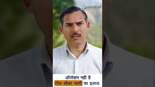 ऑपरेशन नहीं है गॉल ब्लैडर पथरी का इलाज || बिना ऑपरेशन पित्ताशय की पथरी का इलाज ||  पथरी का इलाज ||