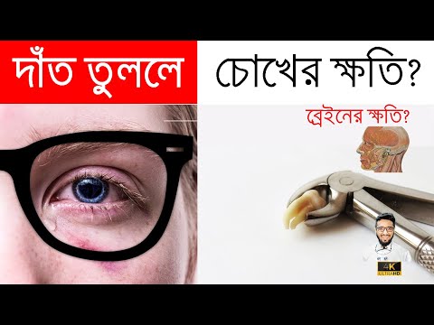 ভিডিও: দাঁত তোলা কি নিরাপদ?