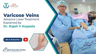Varicose Veins Advance Laser Treatment Explained by Dr Rajah V Koppala  | Avis Hospitals