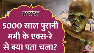 5000 साल पुरानी Mummy के एक्स-रे से क्या पता चला? | Otzi the Iceman | Tarikh E555