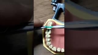 Umas das técnicas para restaurar entre dentes #dentista