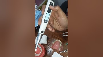 e connect s endomotor new feature