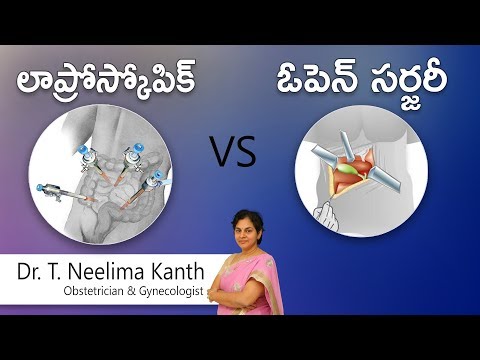 Hi9 | లాప్రోస్కోపిక్ vs ఓపెన్ సర్జరీ ? | డా. టి. నీలిమ కాంత్ | ప్రసూతి వైద్యుడు & గైనకాలజిస్ట్