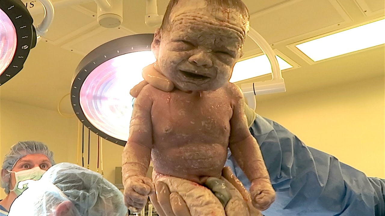 babybirth
