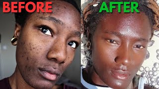 Top 5 Diet Tips For Flawless Youthful Skin