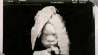 Cassper nyovest ft zola 7 hlengiwe ( audio official)